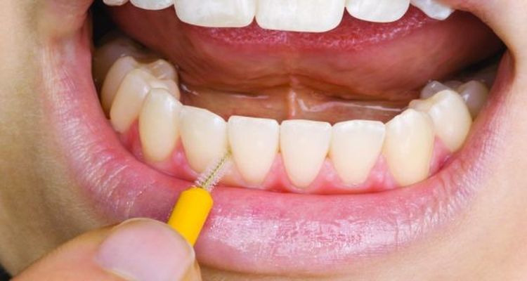 Healthy Gum Tips Hygienist